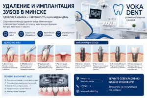 Удаление и имплантация зубов в Минске: что важно знать перед лечением